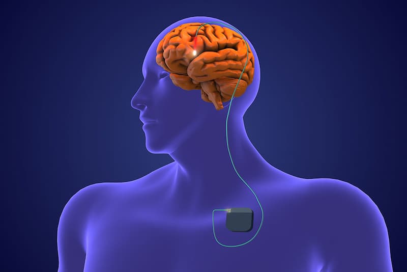 The Brain Was Not Designed for Constant Stimulation